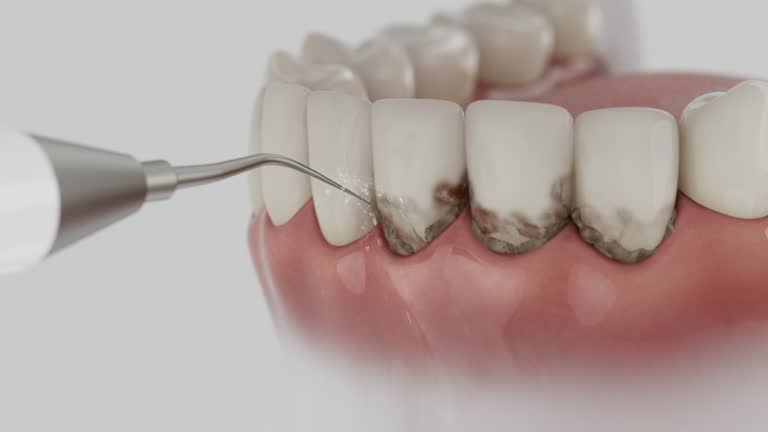 Trusted Emergency Dentist service in Erwin, NC - Dentist Open Now